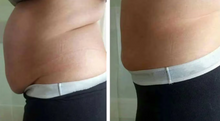 Load image into Gallery viewer, Before and after results of a female customer doing Cryo Slimming. Cryo Slimming eliminates fat instantly and permanently.