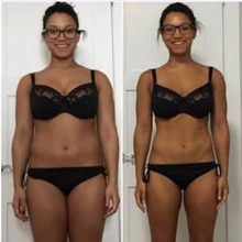 Load image into Gallery viewer, Before and after results of a female customer doing Cryo Slimming. Cryo Slimming eliminates fat instantly and permanently.