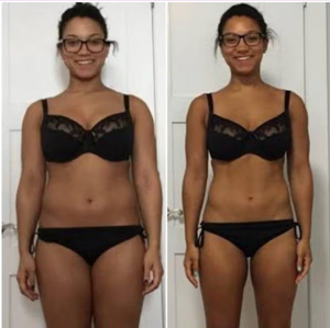 Before and after results of a female customer doing Cryo Slimming. Cryo Slimming eliminates fat instantly and permanently.