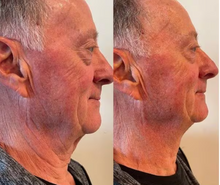 Load image into Gallery viewer, Cryo Lifting Facial